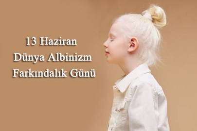 DÜNYA ALBİNİZM FARKINDALIK GÜNÜ