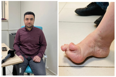 ÇANKIRILI DOKTORDAN MUCİZE DOKUNUŞ